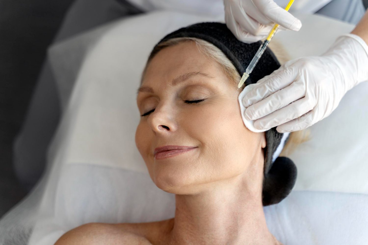 PRP Treatment for Face