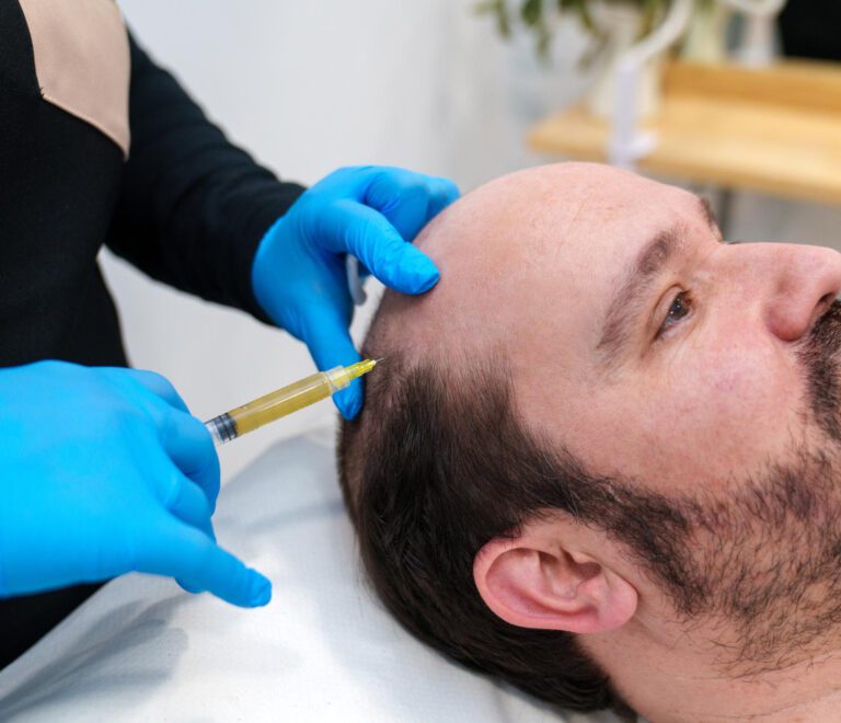 PRP Hair Treatment for Hair Loss: Does It Really Work?