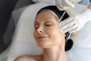 PRP Treatment for Face