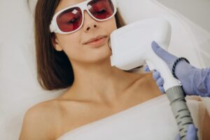 Laser hair removal treatment being performed on a woman's face at H-Bling Wellness in Brea, CA
